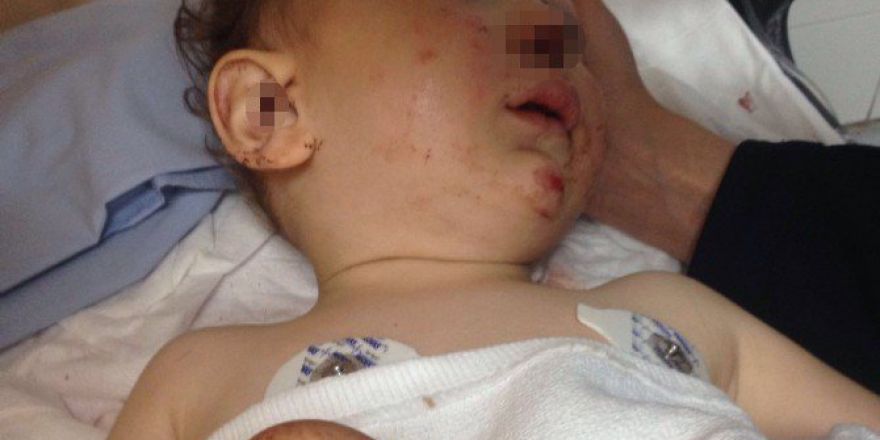 Ankara’da 16 Aylık Bebek 3. Kattan Merdiven Boşluğuna Düştü