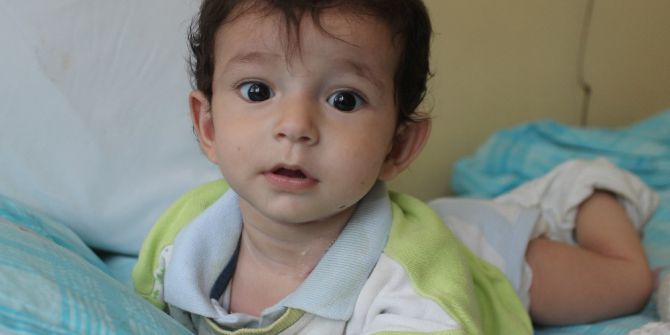 Doğuştan Yemek Borusu Olmayan Bebek Yardım Bekliyor