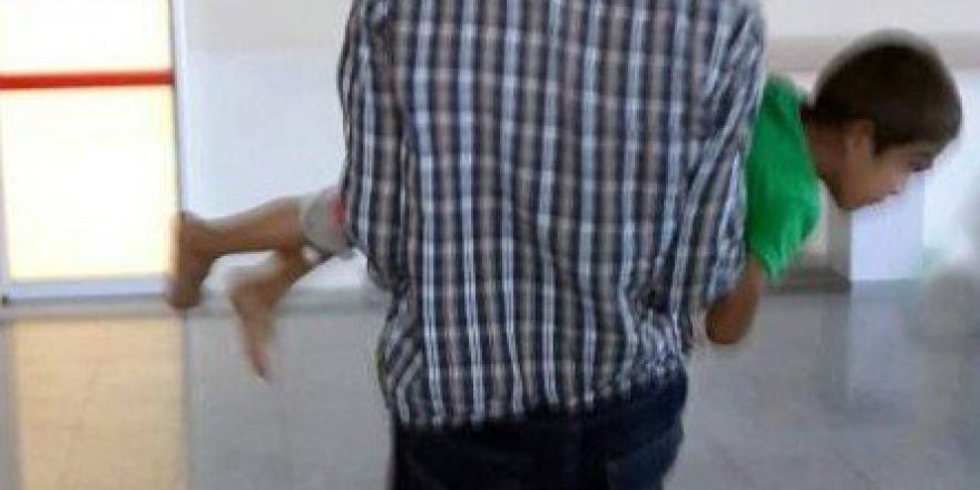 Üzerine Kaynar Su Dökülen Çocuk Yaralandı