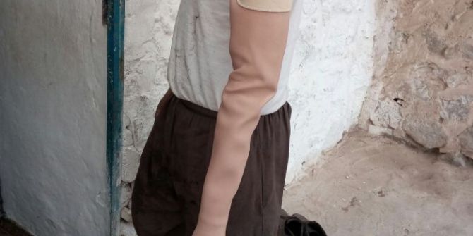 Kolunu Ve Ayağını Kaybeden Ferhat’a Destek Oldular