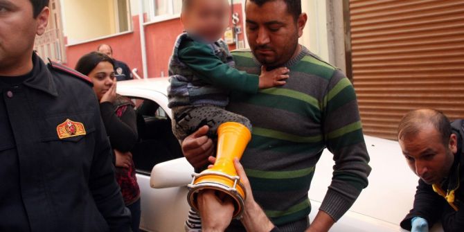 Oyun Oynarken Ayağı Darbukaya Sıkıştı