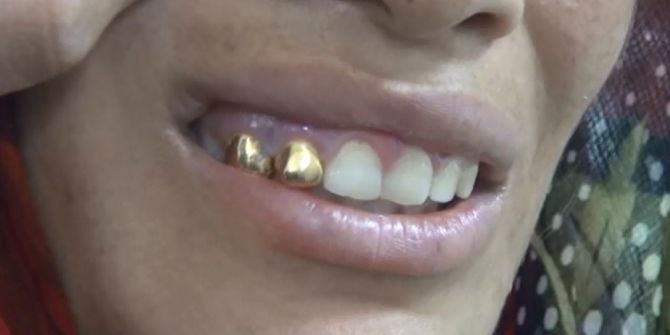 Altın Dişli, Son Model Telefonlu Dilenciler