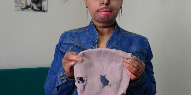 Maskeli Kadın Maskesini Çıkardı