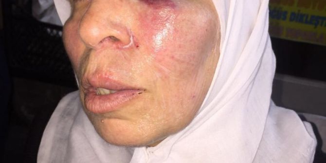 İzmir’de Yaşlı Kadın Acımasızca Yumruklandı