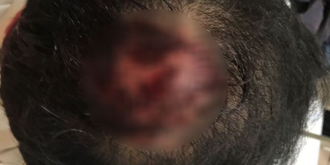 İzmirli İşadamı Öldüresiye Dövüldü