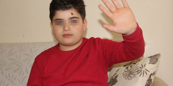 Doğuştan Bacakları Olmayan Küçük Miraç, Şehir Magandalarının Hedefi Oldu