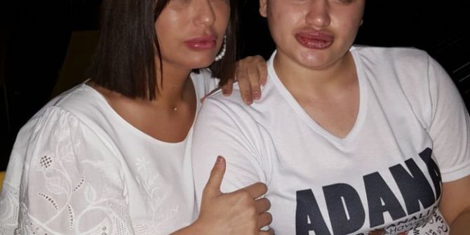 Estetik Mağdurları Buluştu