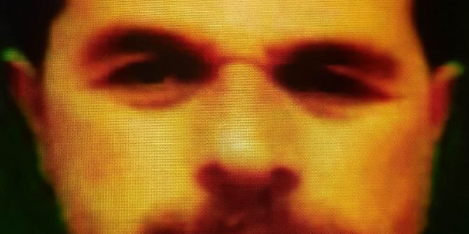 Yeğeninin Silahlı Saldırısına Uğrayan Amca Hayatını Kaybetti