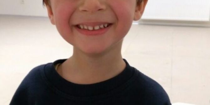 Avm’ye Yürüyen Merdiven Davası