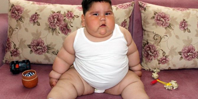 1,5 Yaşında 32 Kilo