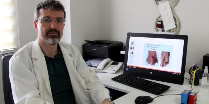 Bu Hastalığın Dünyada Tam Tedavisi Yok: ’Kelebek Hastalığı’