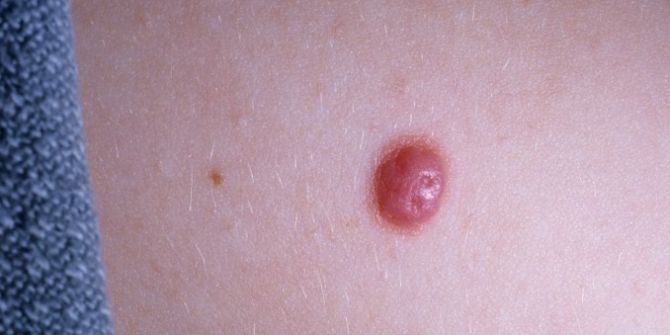 Benlerdeki Bu Değişimlere Dikkat