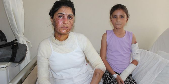 Denizli’de Asitli Dehşet