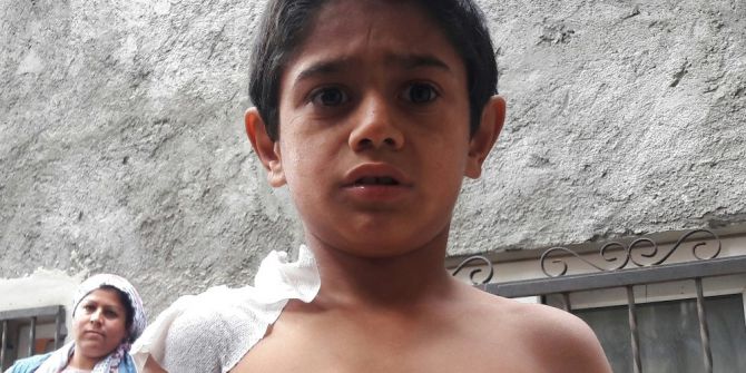 Sıcak Suyla Saldırılan Minik Çocuk Konuştu