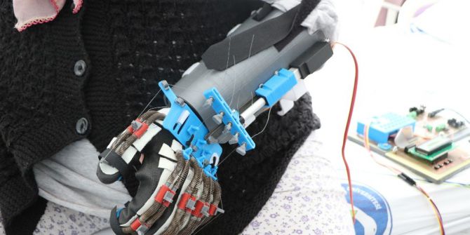 Bu Robot Elinde Felç Olan Hastalara Umut Olacak
