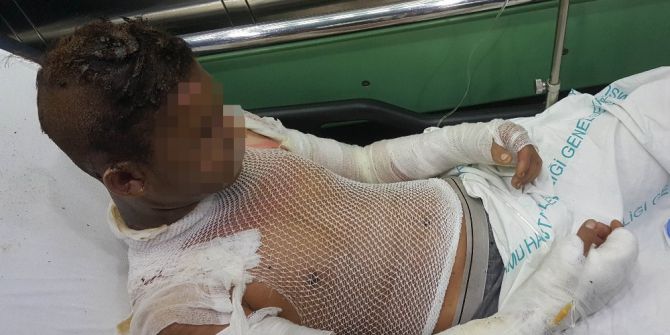 Samsun’da Çakmak Gazı Parladı: 4 Çocuk Yaralı