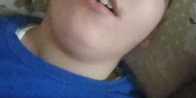 Evde Fenalaşan 13 Yaşındaki Çocuk Hayatını Kaybetti