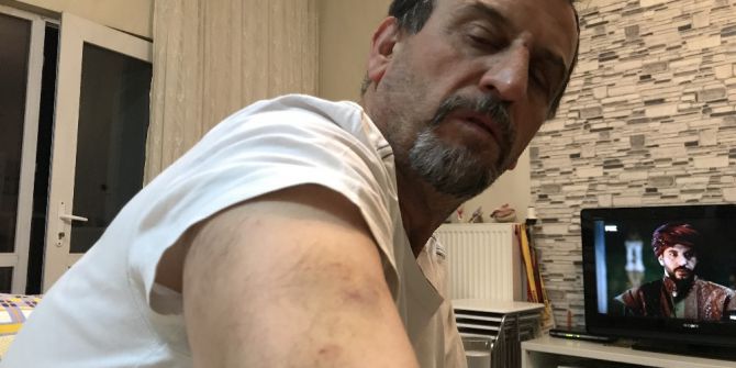 "Engelli Yoluna Park Etme" Dediği İçin Linç Edildi..