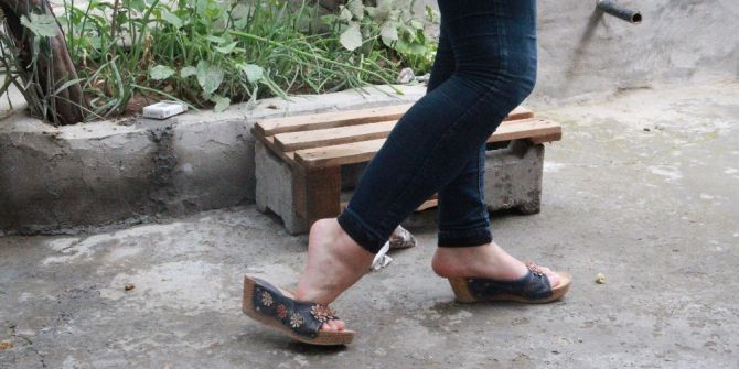 Ayak Parmakları Üzerinde Yürüyen Genç Kız Tedavi Edilmek İstiyor