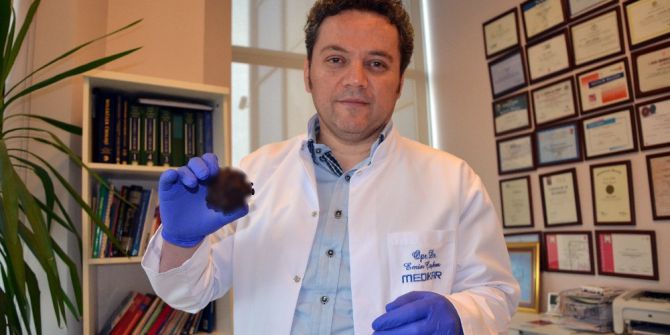 Zor İdrar Yapma Şikayeti İle Geldi, 220 Gram Ağırlığında Mesane Taşı Çıktı