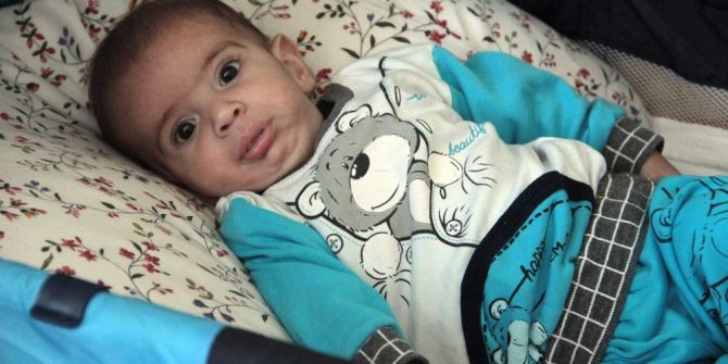 Kusmuğu Boğazını Tıkayan Eymen Bebek “Spastik” Oldu İddiası