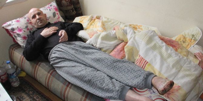 Soğuk Yanığı Hayatını Kararttı