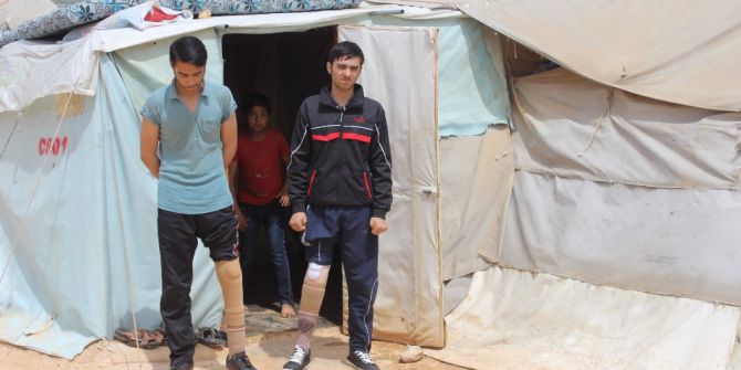 İkizlerin Protez Bacak Sevinci