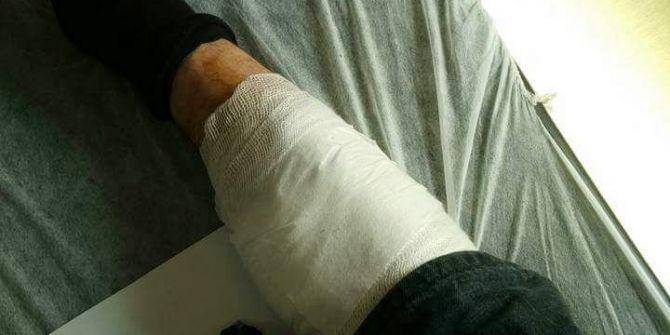 Tırpan Motorunun Fırlattığı Tel Parçası Hastanelik Etti