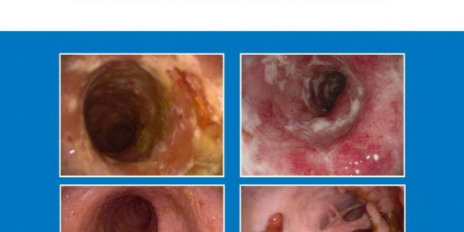 ‘İnflamatuar Bağırsak Hastalıkları Atlası’ Kitabı Yayımlandı