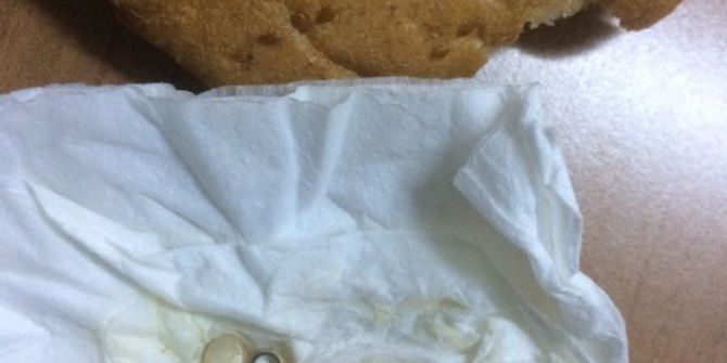 Pideden Çıkan Çivi 4 Dişini Kırdı