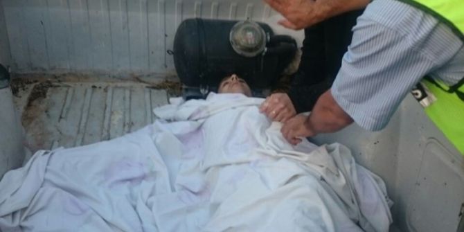 Kalbine Gelen Tek Saçmayla Hayatını Kaybetti