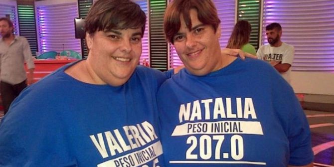 Arjantinli Obez İkizlerden Biri Komada