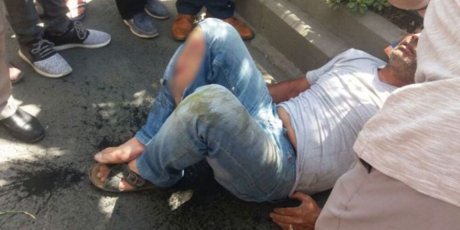 Otomobilin Çarptığı Motosikletli Yaralandı