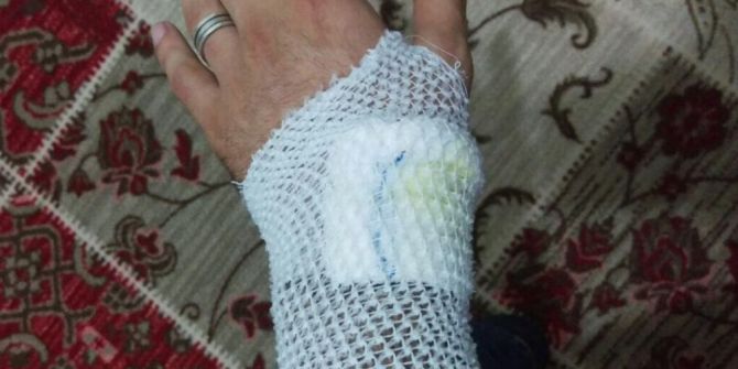 Yakalanan Sahte Polis, Gerçek Polisi Isırıp Kaçmaya Çalıştı