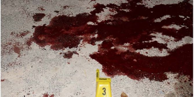 Av Tüfeği İle Yaralama Olayının Zanlısı Tutuklandı