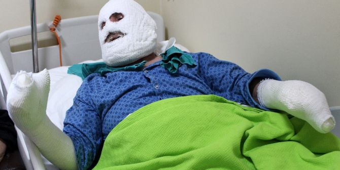 Biriken Gaz Bomba Gibi Patladı