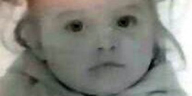 Otelin 3’üncü Katından Düşen 7 Yaşındaki Rus Çocuk Öldü