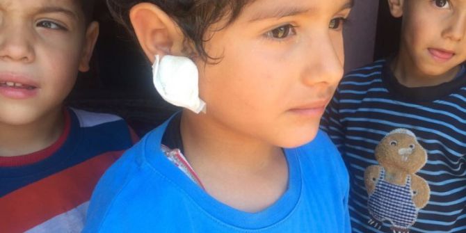 Motosiket Sürücüsü Küçük Çocuğa Çarpıp Böyle Kaçtı