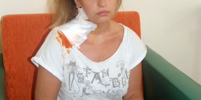 Havai Fişek Gösterisinde Yaralananlar Kabus Gecesini Anlattı