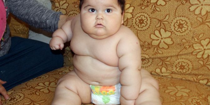 3,5 Kilo Doğdu 8 Ayda 20 Kiloya Ulaştı