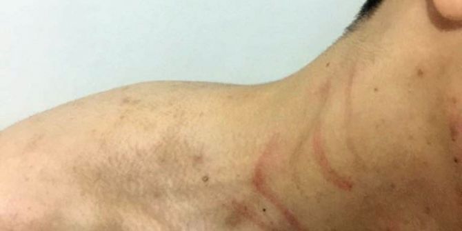 Hırsızlıkla Suçladıkları Genci Önce Darp Ettiler, Sonra Tokalaşmak İstediler