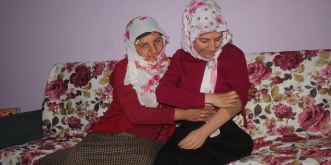 Protez Kolla Yıllar Sonra Gelen Mutluluk