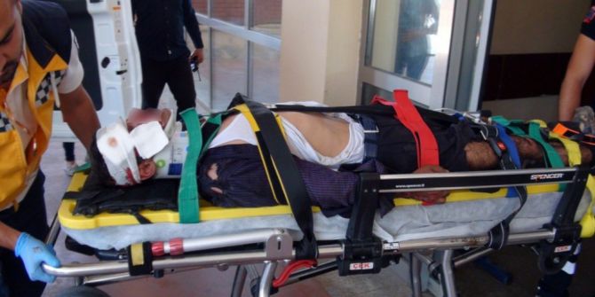 Seyir Halindeki Kamyonetten Düşen İşçi Ağır Yaralandı