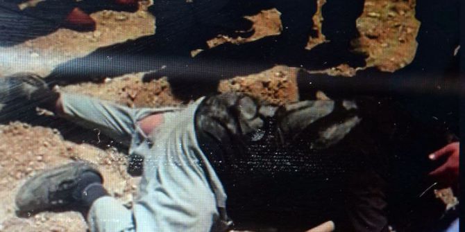 Kepçenin Altında Kalan Şahıs Ağır Yaralandı