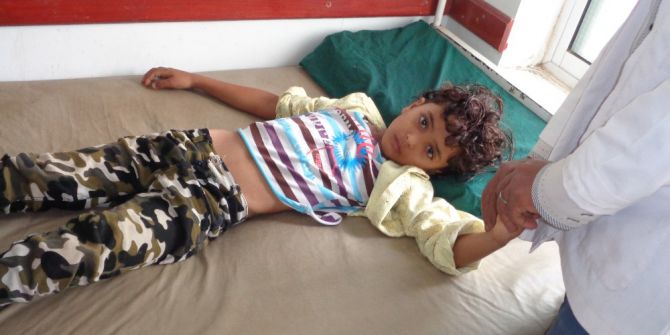 Dünya Sağlık Teşkilatı: “Yemen’de Koleradan 1146 Kişi Öldü”