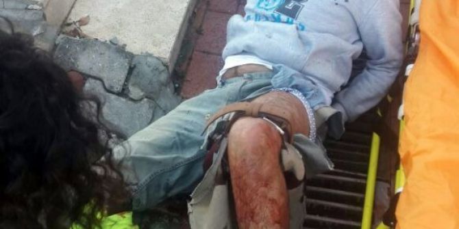 Polise Bıçakla Saldıran Kablo Hırsızı Vurularak Yakalandı