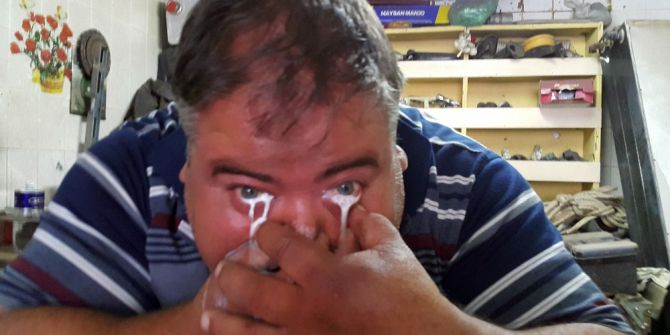 Burnundan Aldığı Sütü Gözünden Fışkırtan Adam Şaşırtıyor