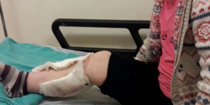 Zihinsel Engelli Kadına Sokak Köpeği Saldırdı