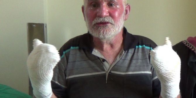 Sahur İçin Yemek Isıtmaya Çalışan Aşçı, Biriken Gazın Patlamasıyla Yandı