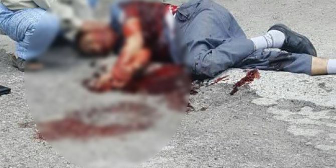 Eski Damadı 13 Yerinden Bıçakladı